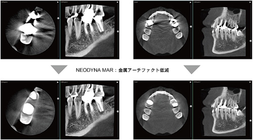 CT Scan Image 2