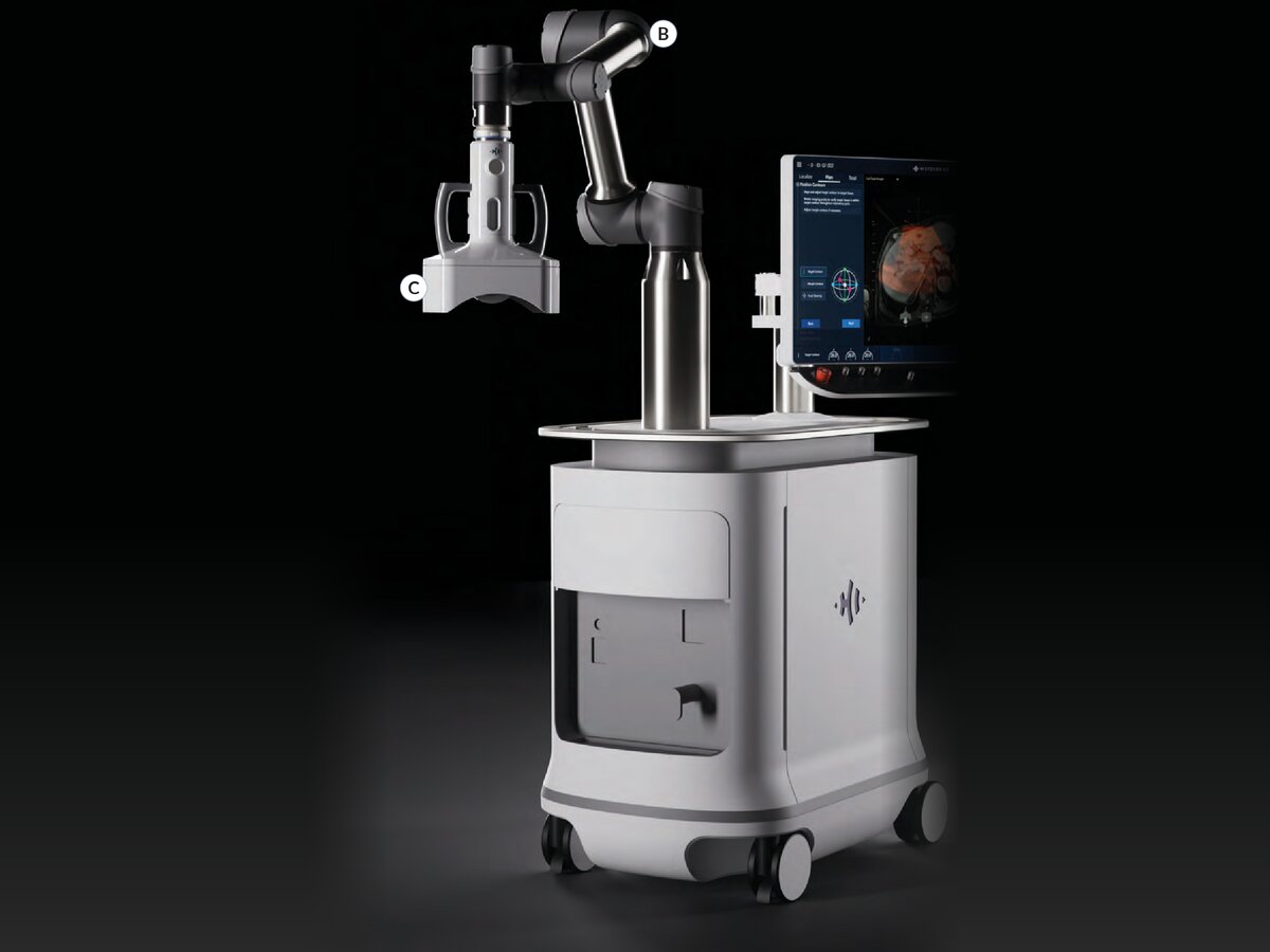 Histotripsy edison system